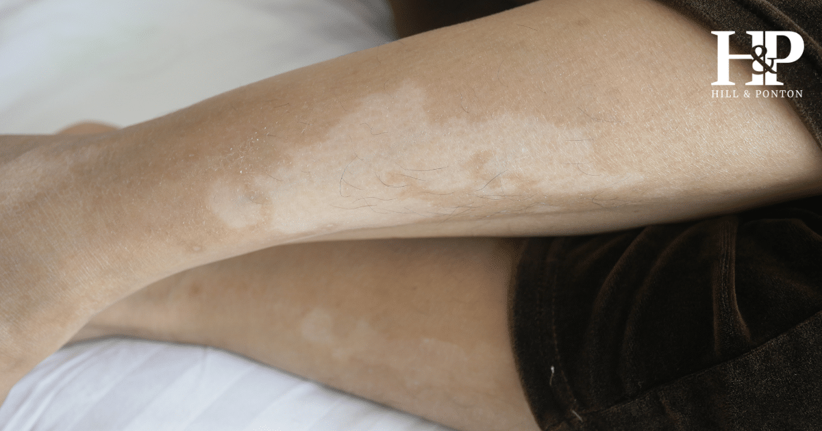 Gulf War Skin Conditions