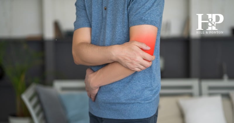 Cubital Tunnel Syndrome VA disability rating